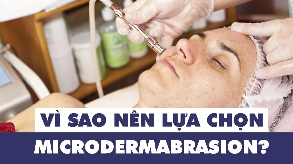 Microdermabrasion là gì? Vì sao nên lựa chọn phương pháp microdermabrasion?