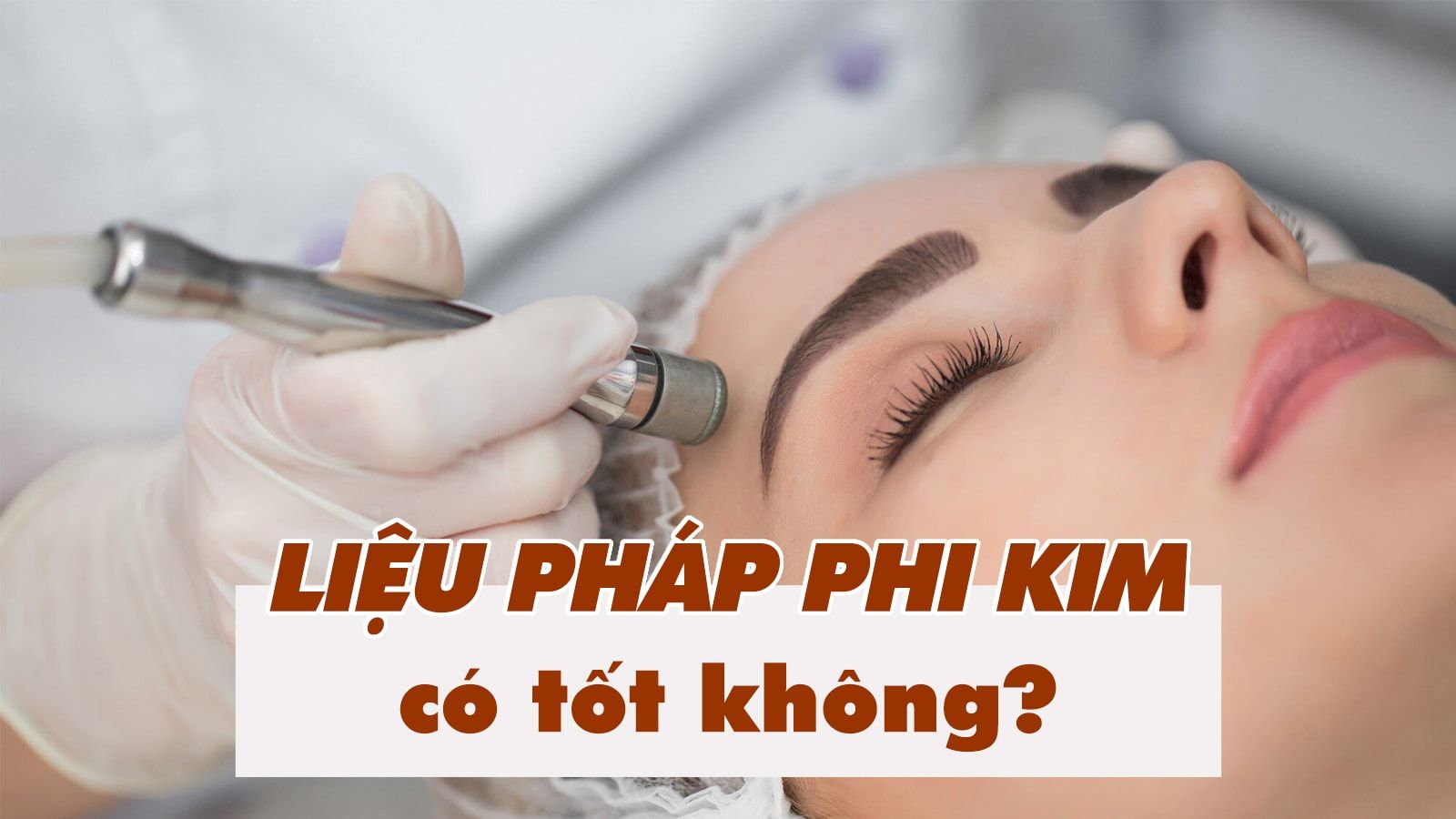 Phi kim có tốt không? Có nên phi kim trị sẹo, trị mụn hay trẻ hóa da?