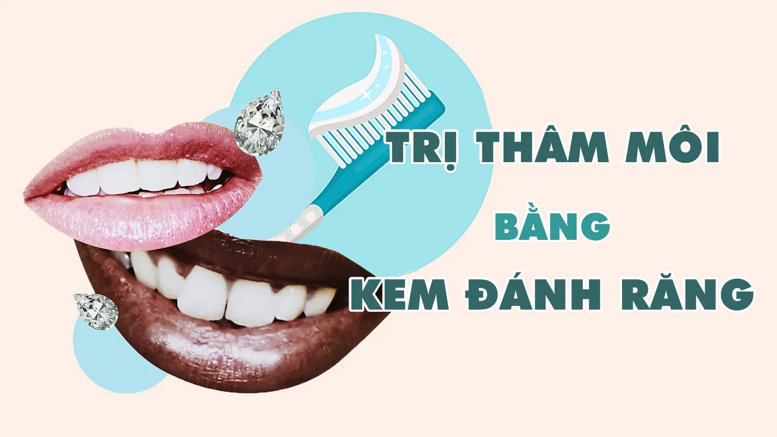 5 cách trị thâm môi bằng kem đánh răng cấp tốc, đơn giản tại nhà