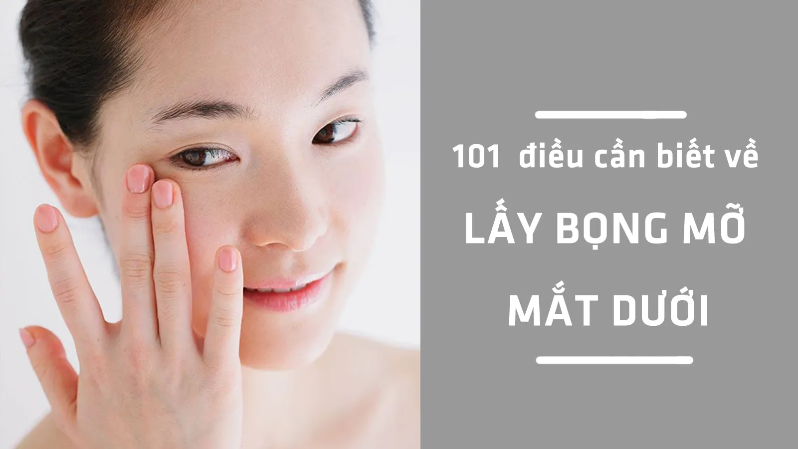 Có nên lấy bọng mỡ mắt dưới để ‘hồi sinh’ nét thanh xuân?