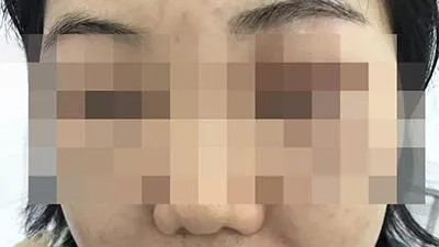 Cẩn trọng khi sử dụng tế bào gốc làm đẹp
