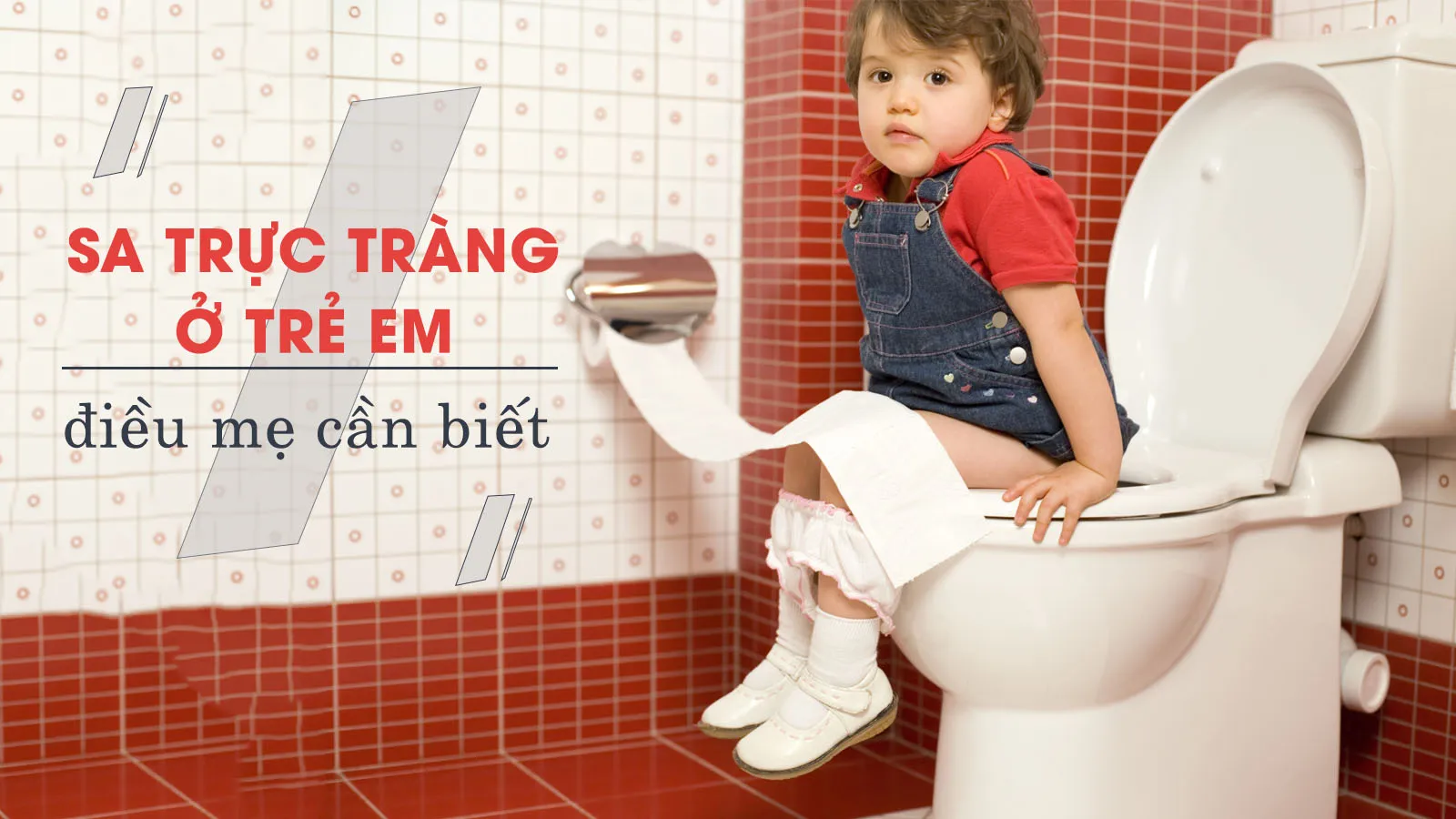 Sa trực tràng ở trẻ em – cha mẹ chủ quan khiến trẻ tái phát nhiều lần