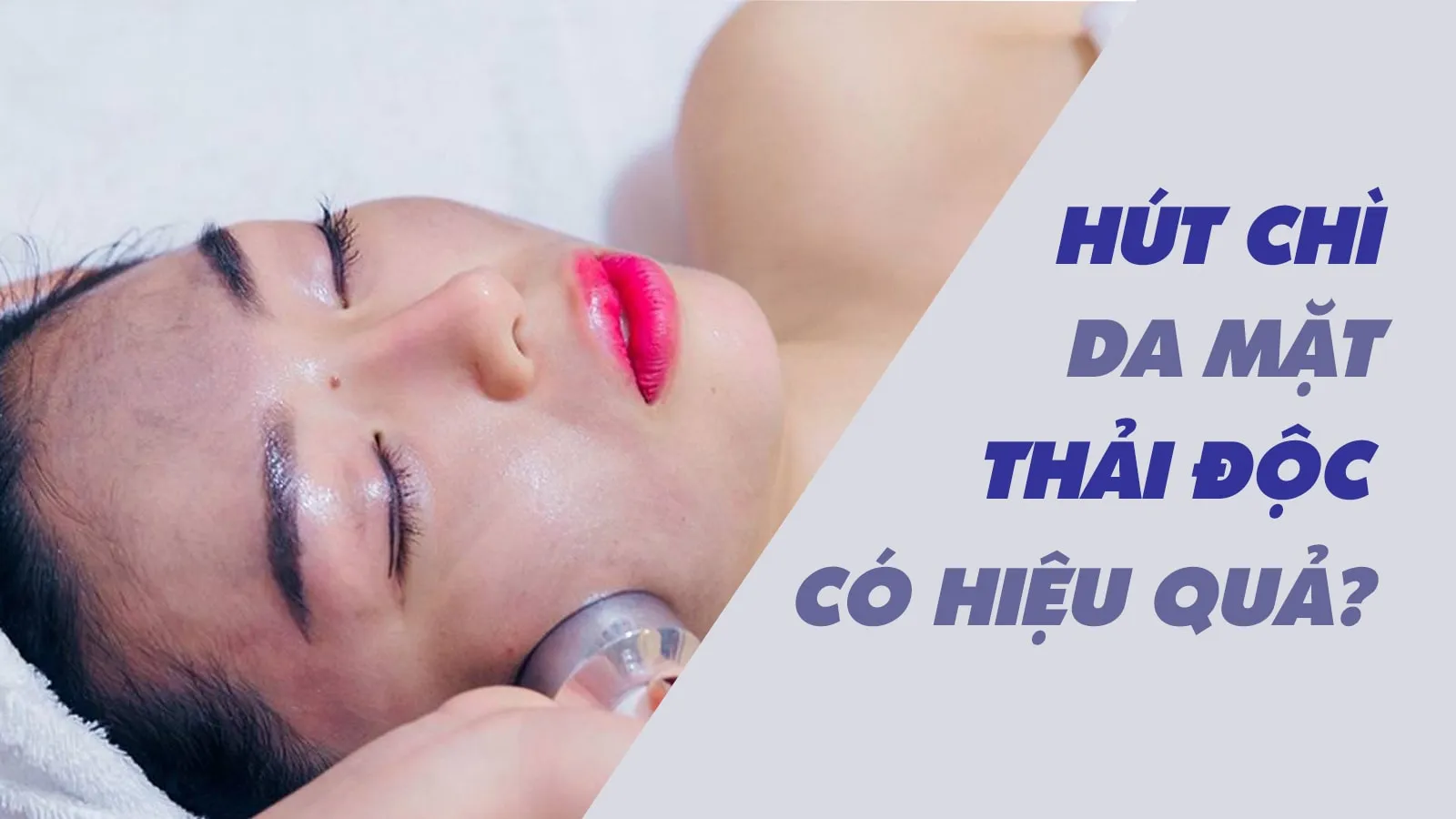 Hút chì da mặt và những sự thật mà hội chị em mê làm đẹp phải biết