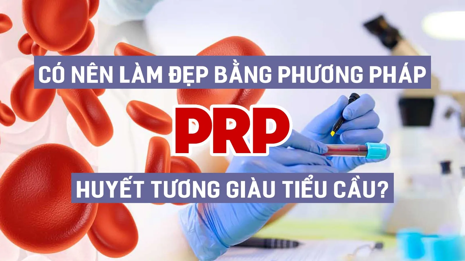 Phương pháp PRP – cấy máu tự thân và những hệ lụy