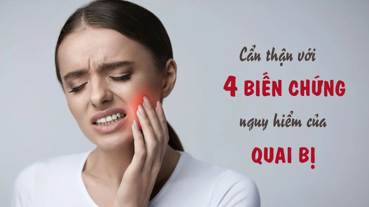 Quai bị: Triệu chứng, đường lây nhiễm và vắc xin phòng ngừa