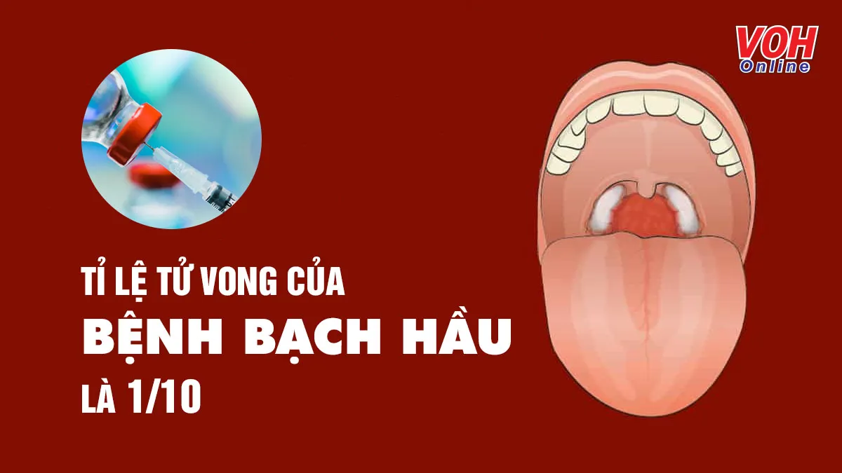 Tiêm phòng bệnh bạch hầu thế nào là đúng và đủ?