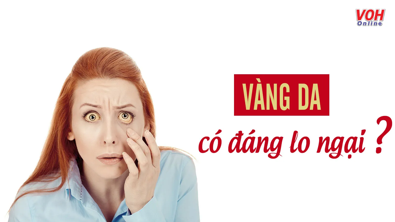 Những điều cần biết về hiện tượng vàng da