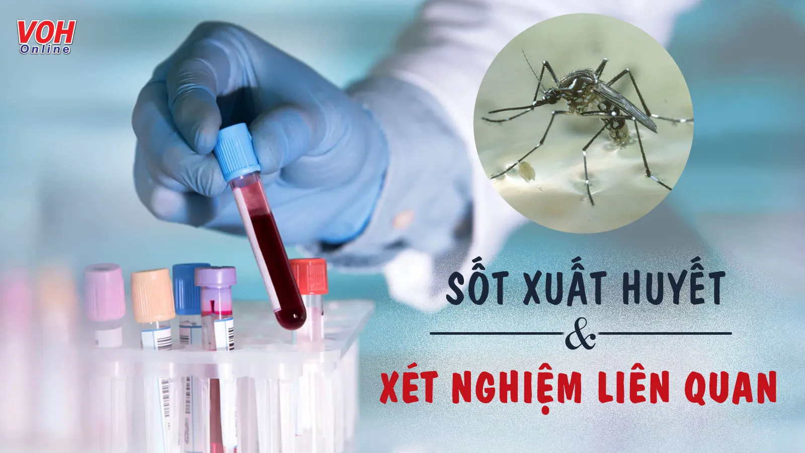 Có mấy loại xét nghiệm sốt xuất huyết?