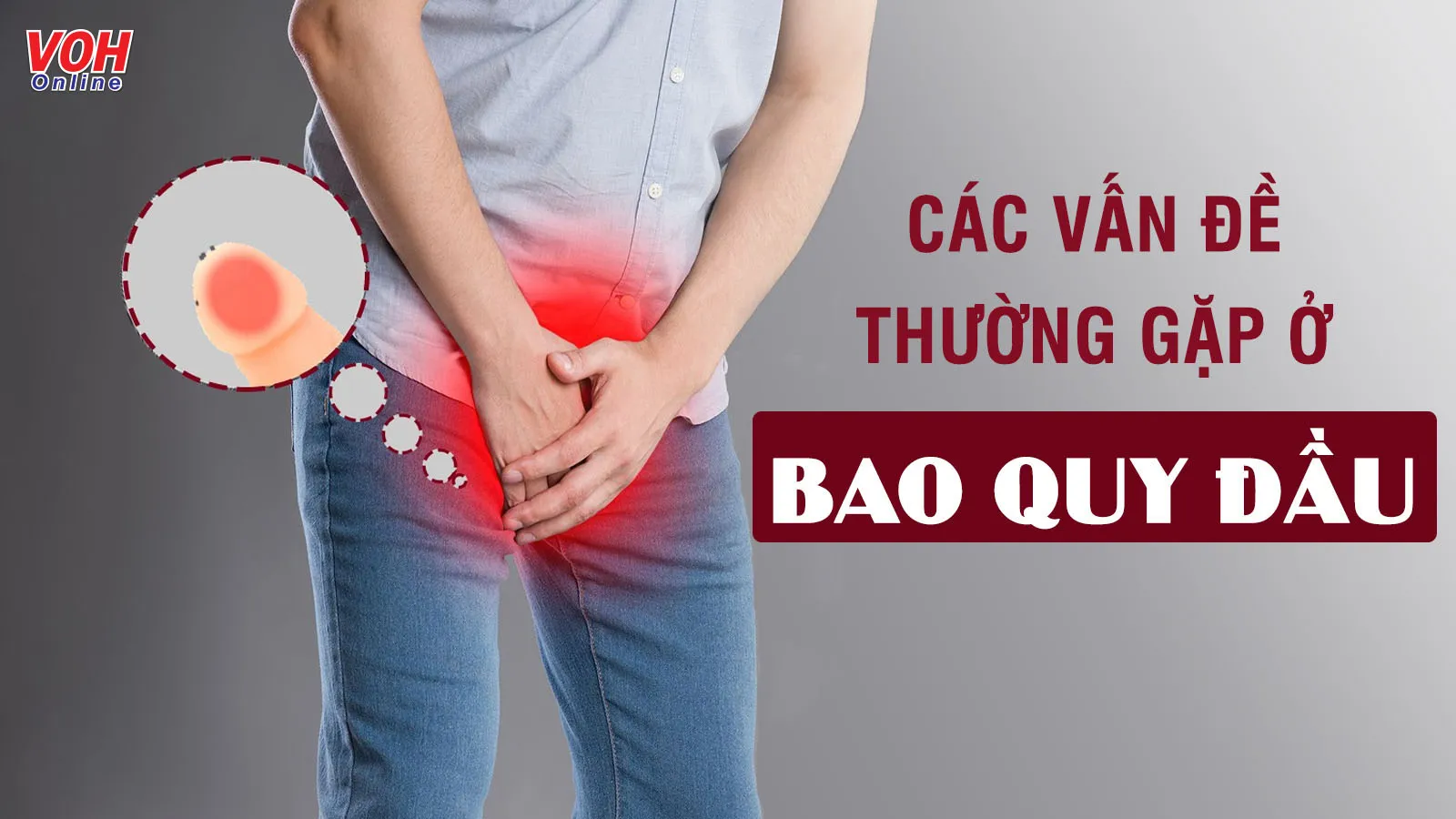 Các bệnh về bao quy đầu thường gặp và cách đối phó