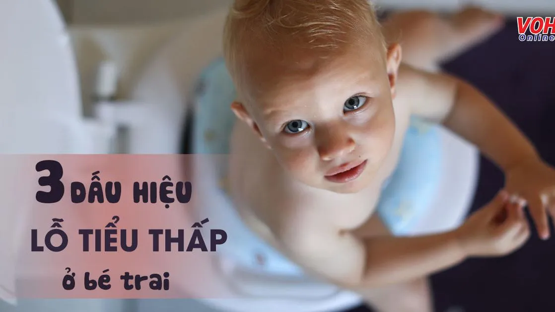 Tổng quan kiến thức về dị tật lỗ tiểu thấp ở bé trai