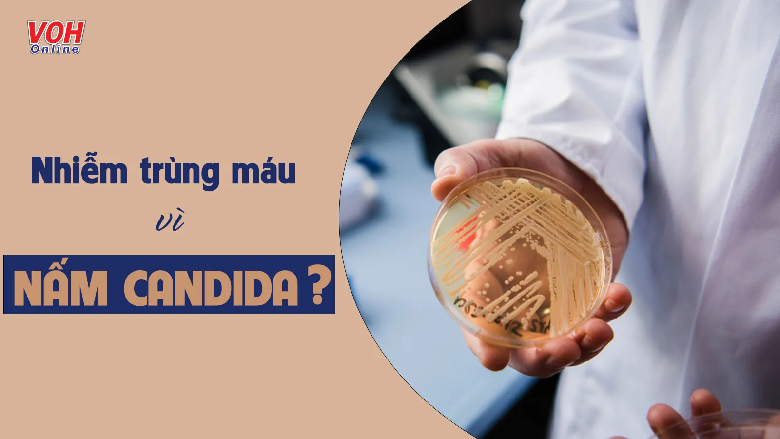 Nhiễm nấm Candida là gì? Nhận biết, điều trị và phòng ngừa