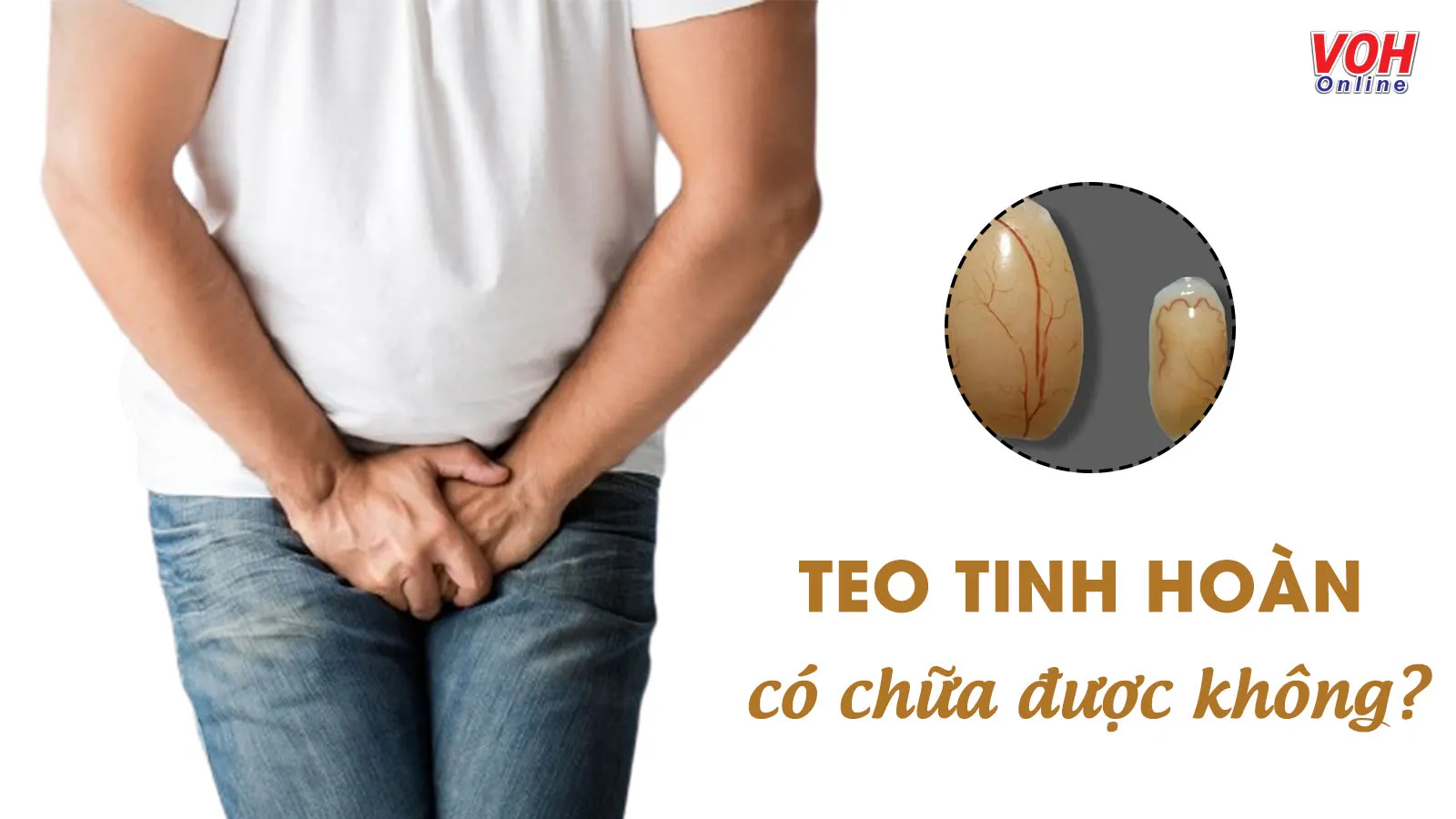 Nhận biết và cải thiện tình trạng teo tinh hoàn