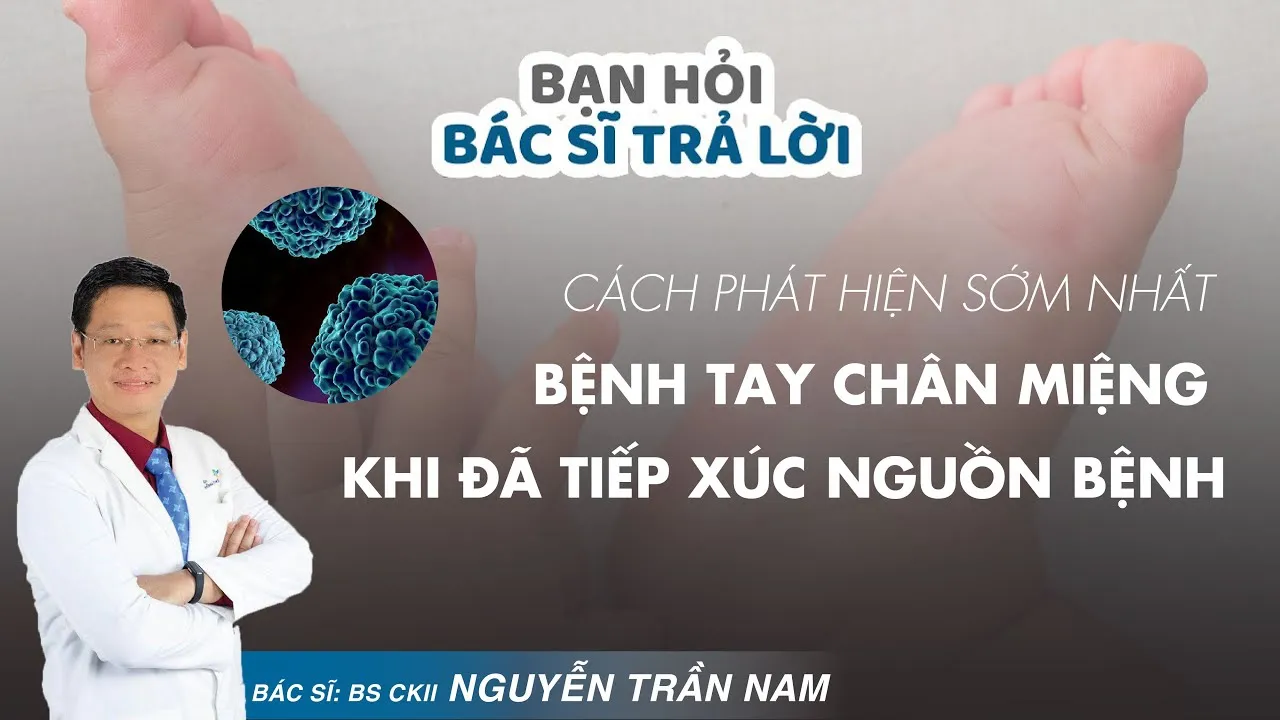 Bác sĩ Trần Nam chia sẻ cách phát hiện sớm bệnh chân tay miệng 