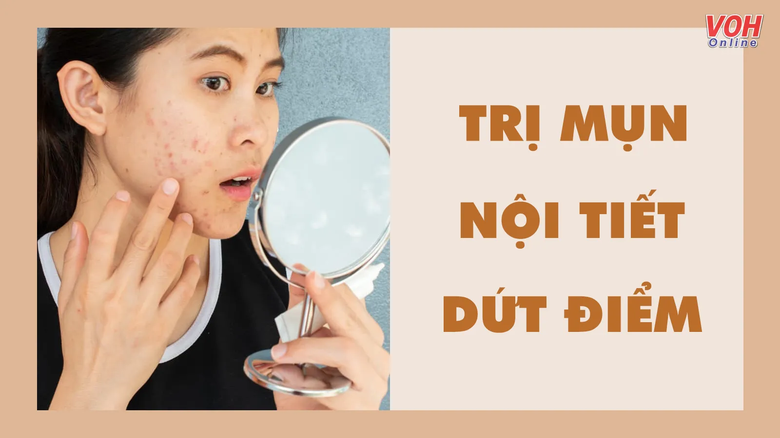 Cách trị mụn nội tiết dứt điểm, đẩy lùi làn da sần sùi dai dẳng