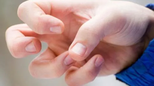 Bệnh động kinh có thể uống thuốc, sống chung một cách bình thường