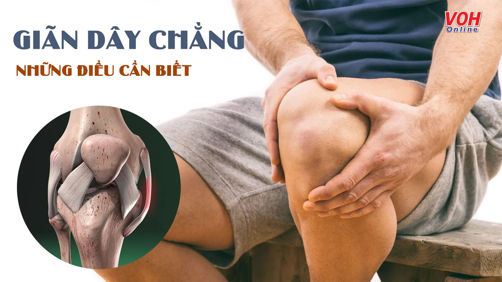 Giãn dây chằng: Nguyên nhân, triệu chứng và cách điều trị