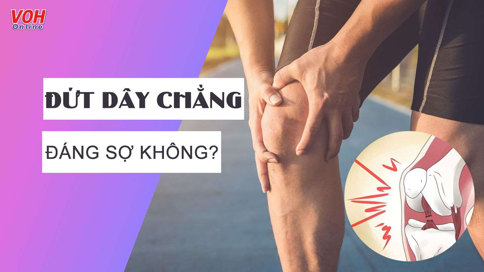 Đứt dây chằng là gì? Cách nhận biết và điều trị