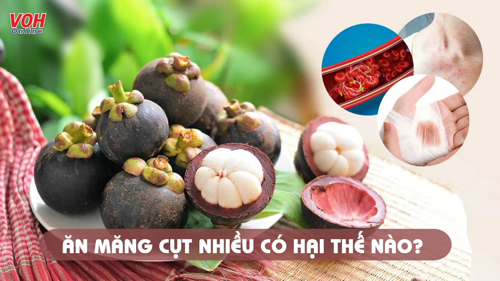 Ăn măng cụt nhiều có tốt không?