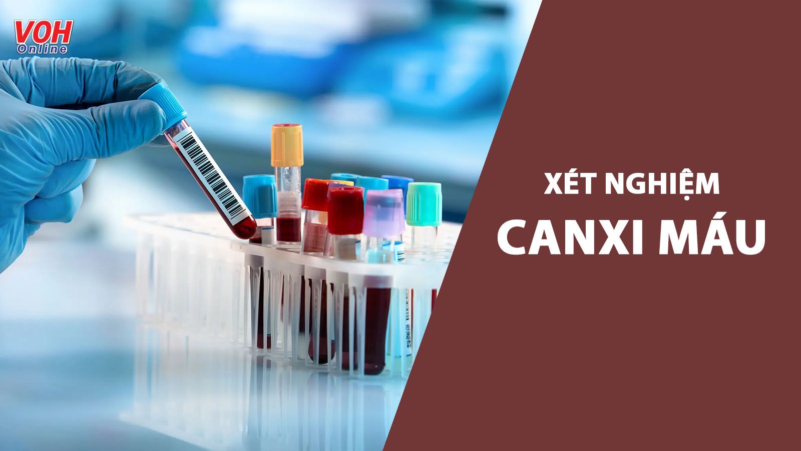Xét nghiệm canxi máu là gì, vì sao cần thực hiện?
