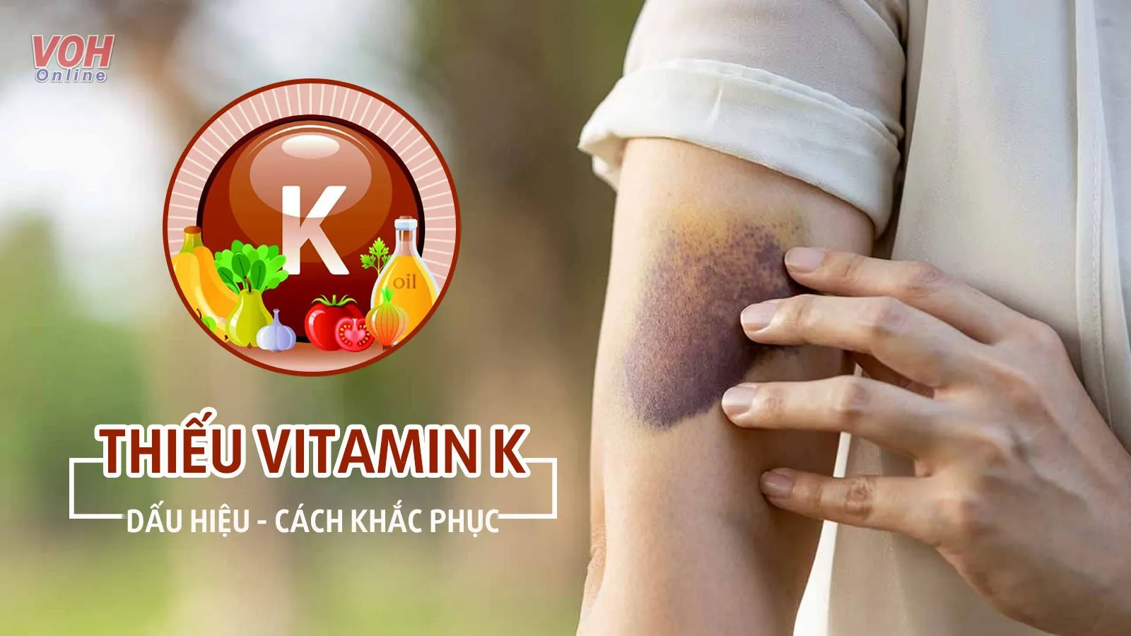 Nhận biết - cải thiện thiếu vitamin K ở trẻ sơ sinh và người lớn