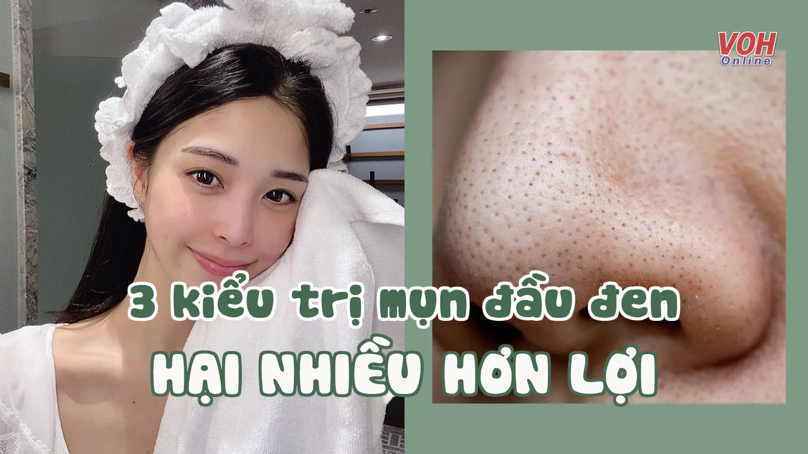 3 điều tối kị khi trị mụn đầu đen