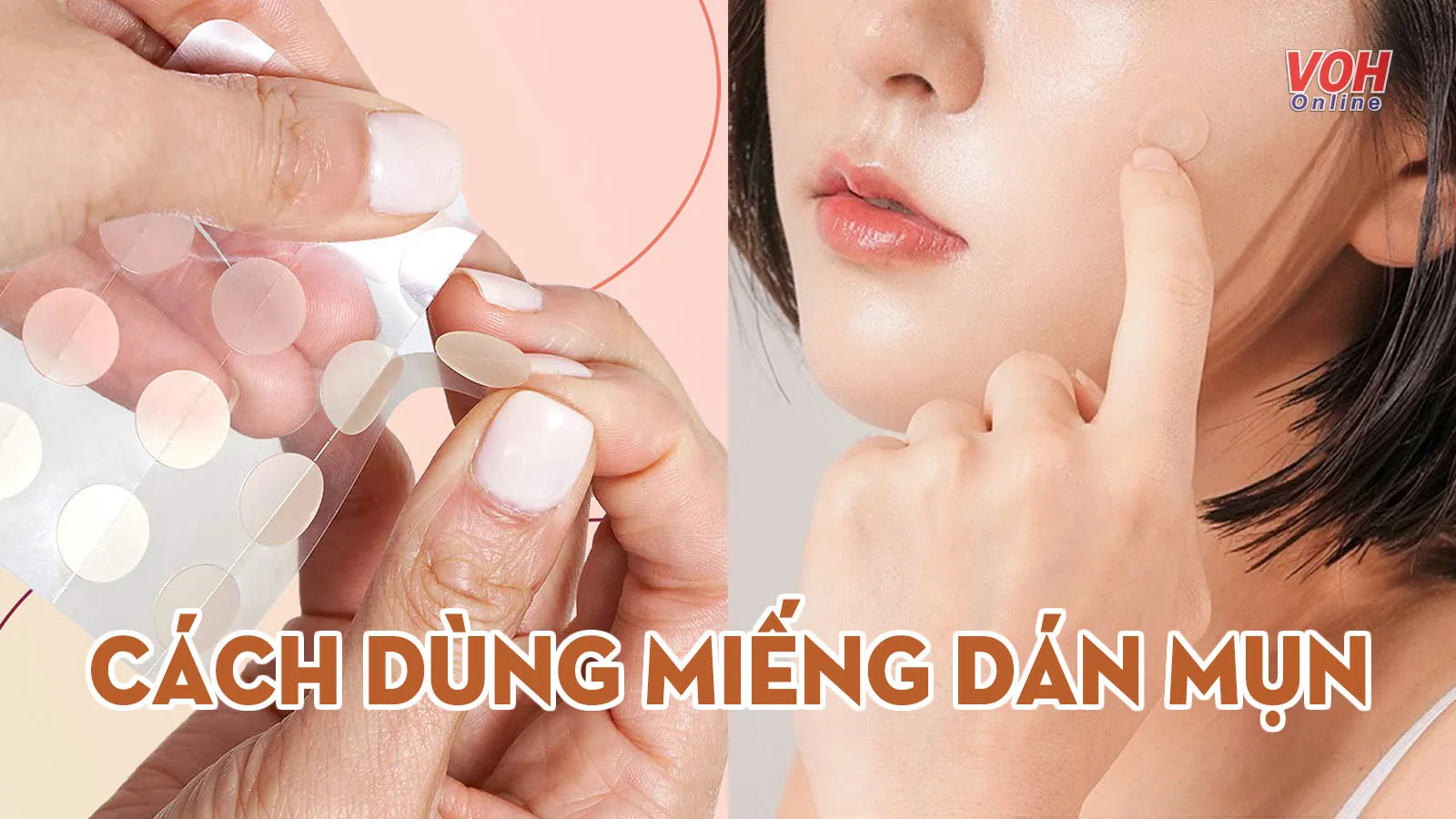 Miếng dán mụn có tác dụng gì? Cách chọn và sử dụng miếng dán mụn