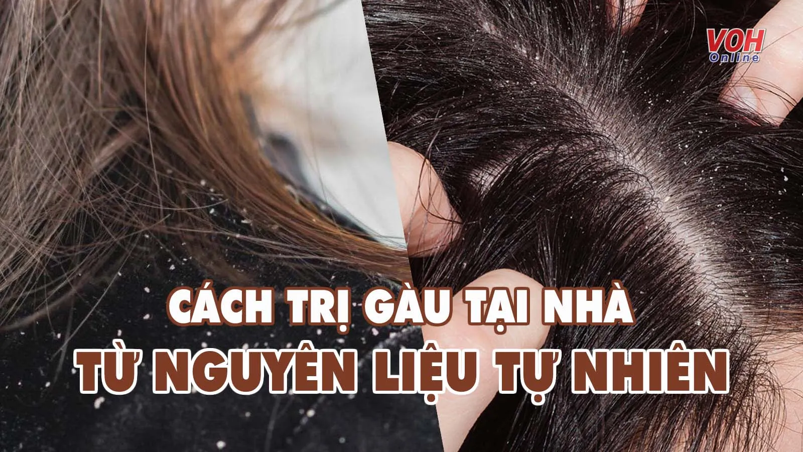 8 cách trị gàu tại nhà từ nguyên liệu tự nhiên, dễ kiếm