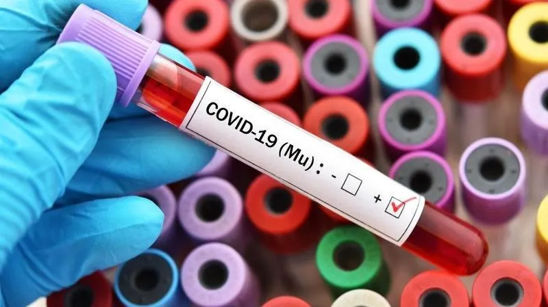 Biến thể MU nguy hiểm như thế nào so với biến thể Delta?