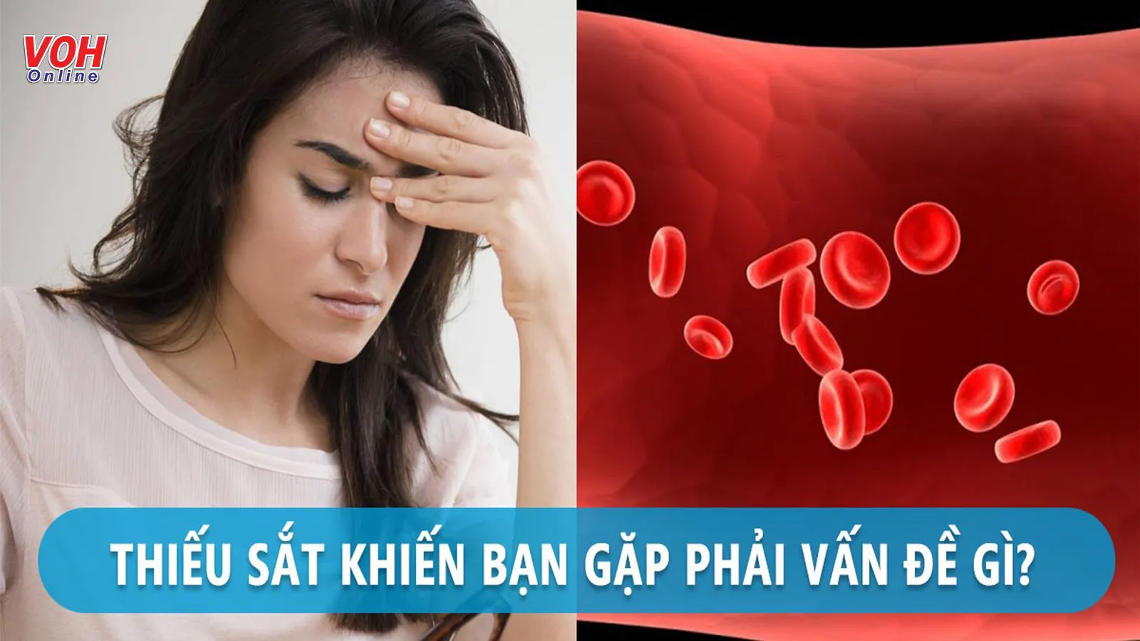 Thiếu sắt gây bệnh gì? 4 dấu hiệu thiếu sắt cơ thể ‘cảnh báo’