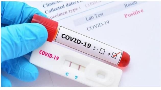 Bộ Y tế: Không được lợi dụng dịch bệnh để tăng giá xét nghiệm COVID-19