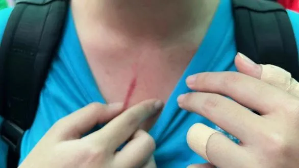 Trường Quốc tế TPHCM nhận một phần trách nhiệm liên quan vụ phụ huynh tố con bị đánh