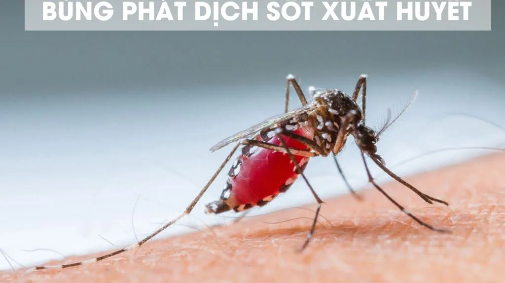 Lo ngại dịch chồng dịch - cộng đồng cần chung tay với ngành y tế
