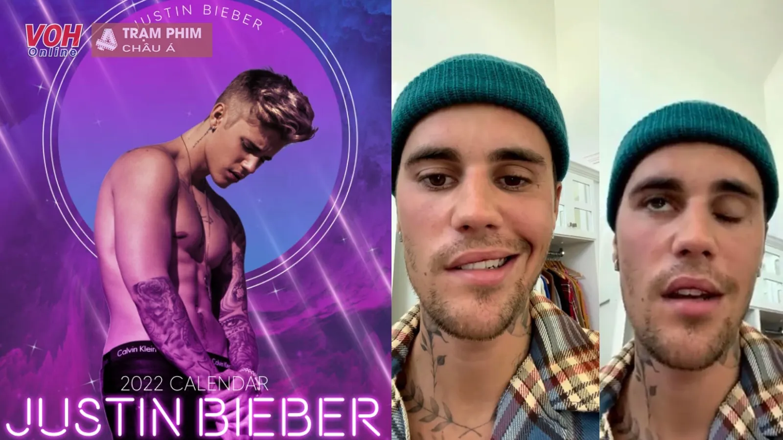 Justin Bieber bị liệt nửa mặt do virus hiếm