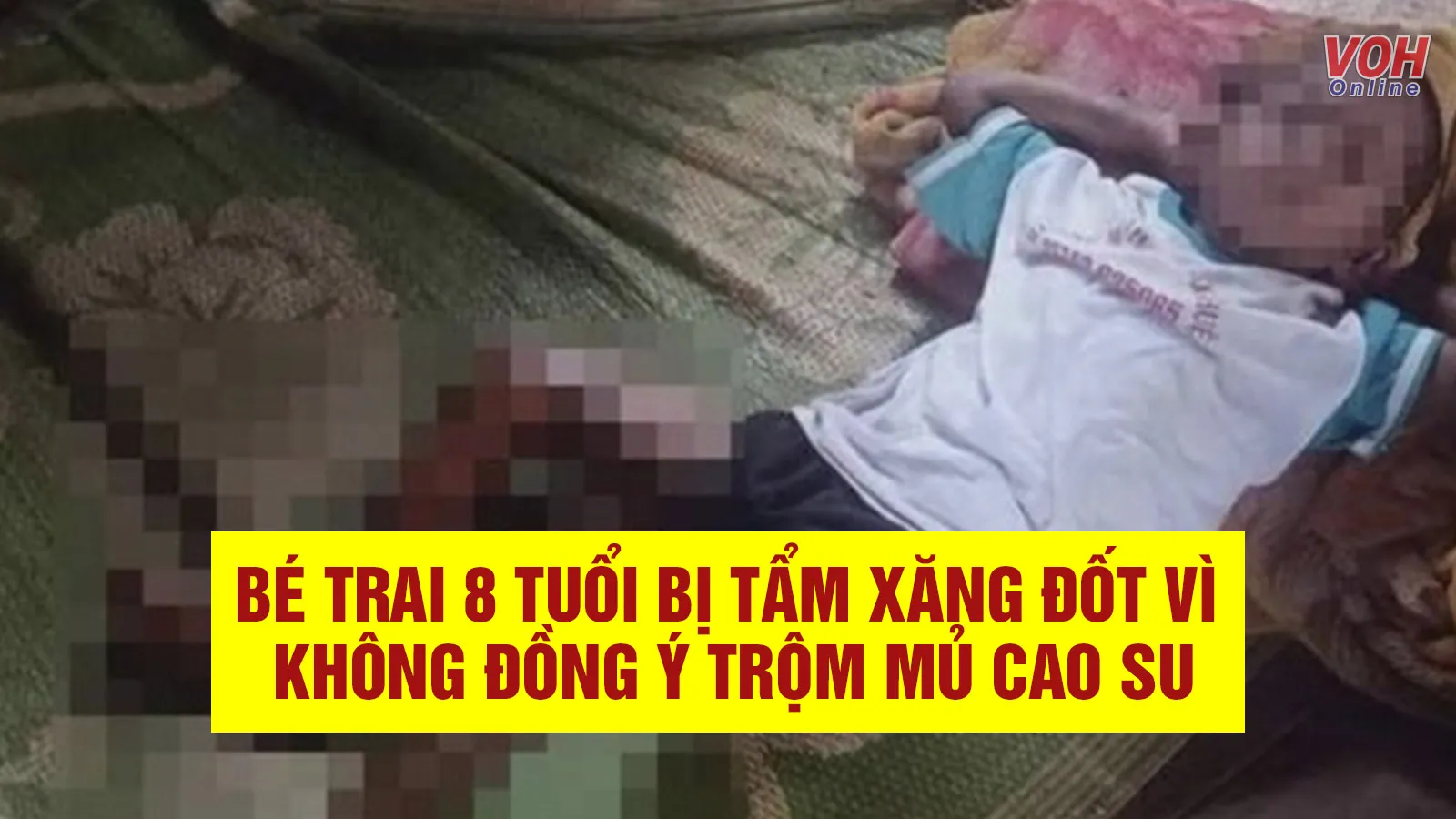 Tin nhanh chiều 12/7: Bé trai 8 tuổi bị tẩm xăng đốt vì không đồng ý trộm mủ cao su