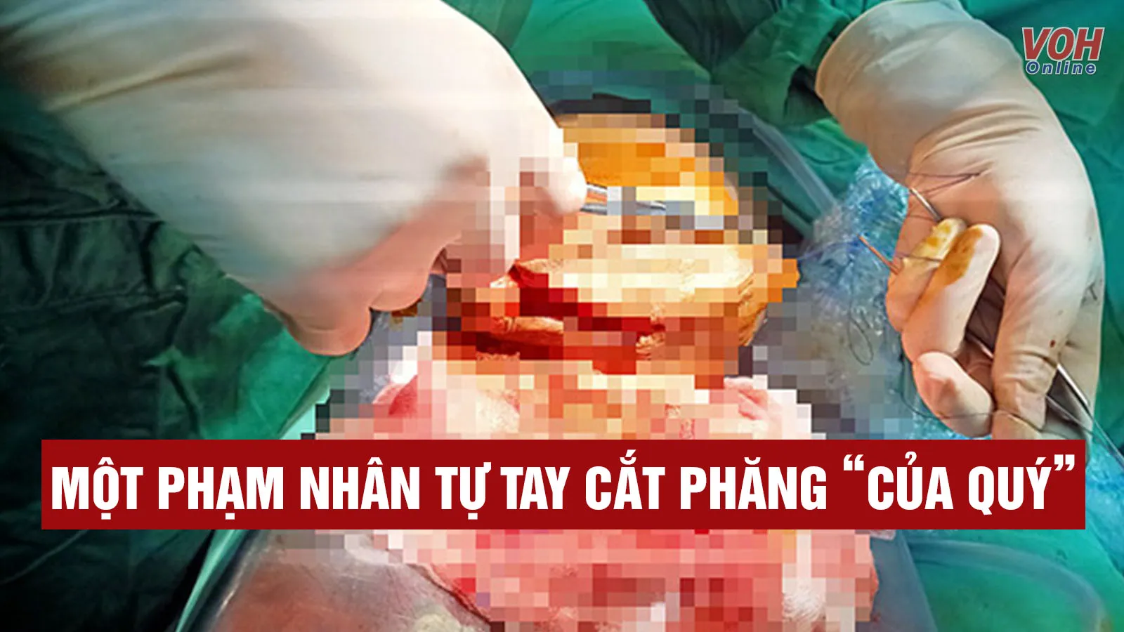 Tin nhanh trưa 13/7: Một phạm nhân tự tay cắt phăng của quý