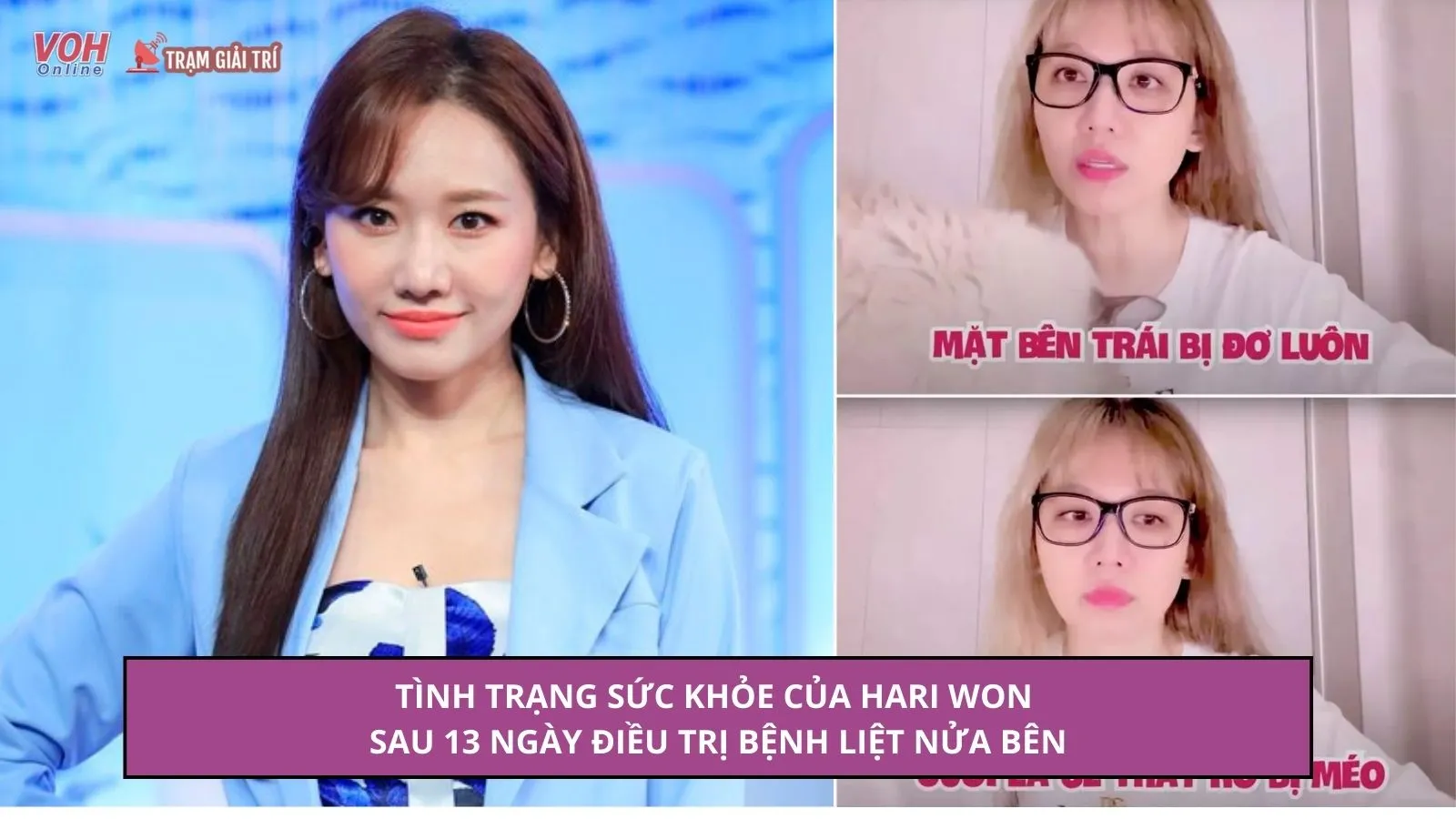 Hari Won cập nhật tình trạng sức khỏe sau thời gian điều trị bệnh gây liệt nửa mặt