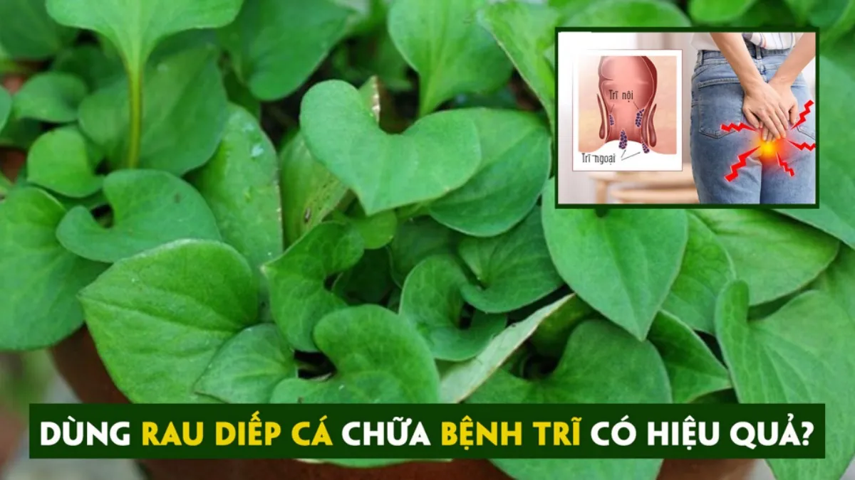 Những cách đẩy lùi bệnh trĩ bằng rau diếp cá nhanh và hiệu quả