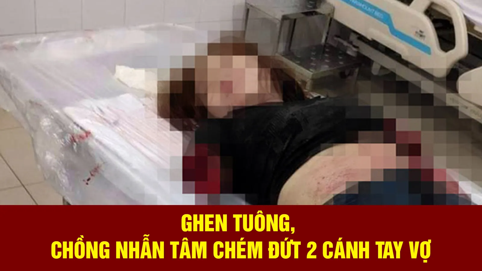 Tin nhanh trưa 15/9: Kinh hãi gã chồng nhẫn tâm chém đứt 2 cánh tay vợ