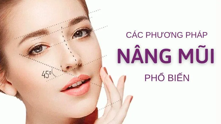 Các phương pháp nâng mũi mới và phổ biến hiện nay