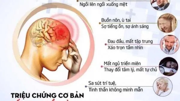 Hội chứng tiền đình nguy hiểm như thế nào?