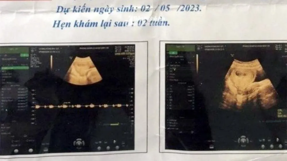 Vụ nữ sinh bị xâm hại đến mang thai: Nghi phạm 70 tuổi đã tử vong