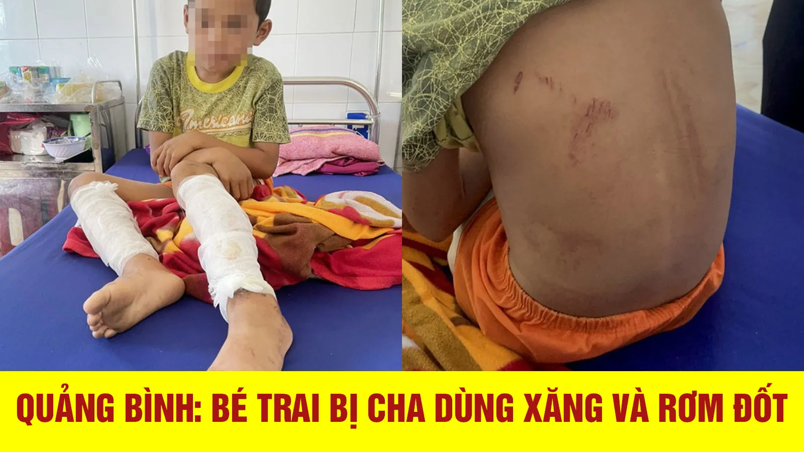 Tin nhanh chiều 6/10: Bé trai bị cha dùng xăng và rơm đốt ở Quảng Bình