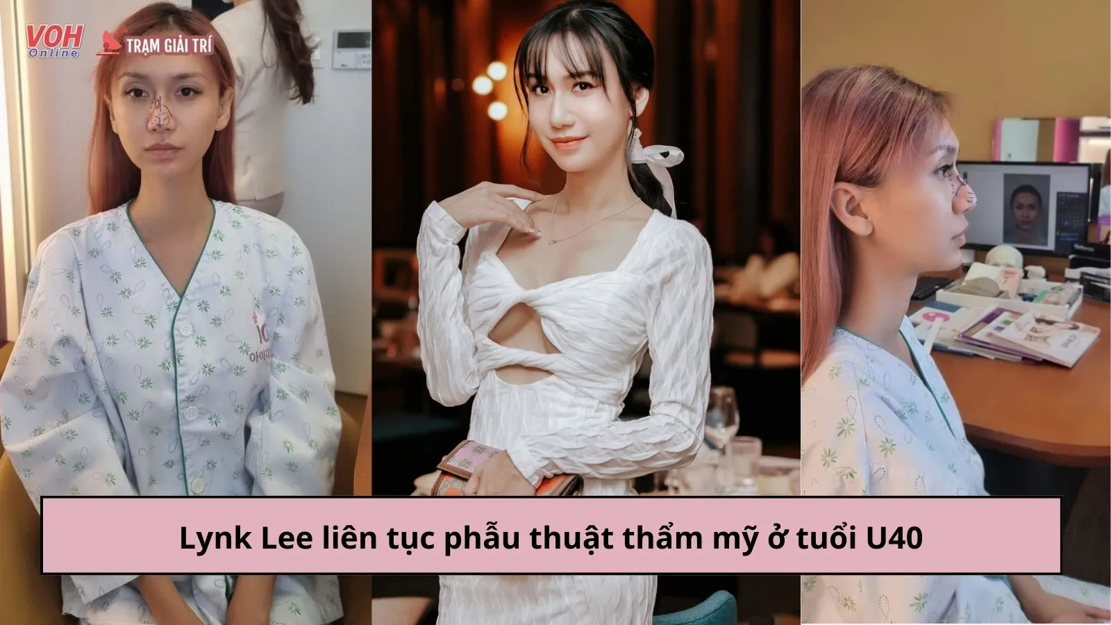 Lynk Lee liên tục phẫu thuật thẩm mỹ, quyết tâm làm con gái hoàn chỉnh ở tuổi U40