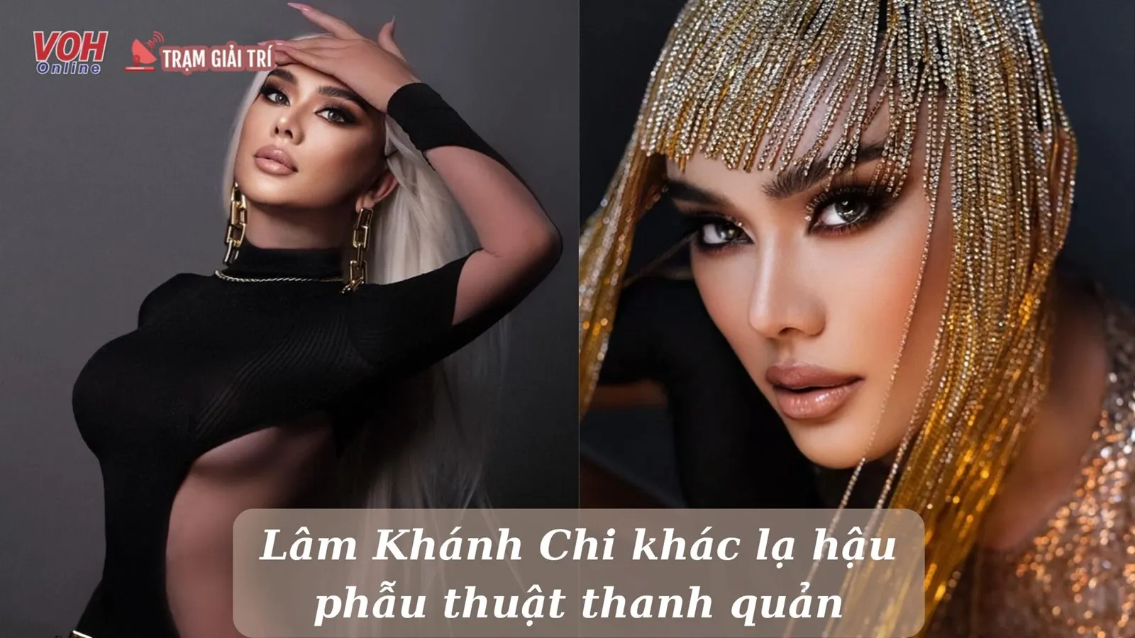 Lâm Khánh Chi xuất hiện trong tạo hình mới hậu phẫu thuật thanh quản