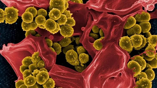 Nhiễm khuẩn là nguyên nhân gây tử vong cao thứ hai trên toàn thế giới