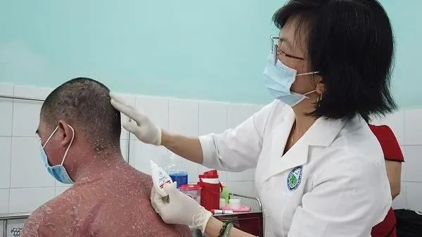 Mua thuốc chữa vảy nến trên mạng, nhiều bệnh nhân nhập viện
