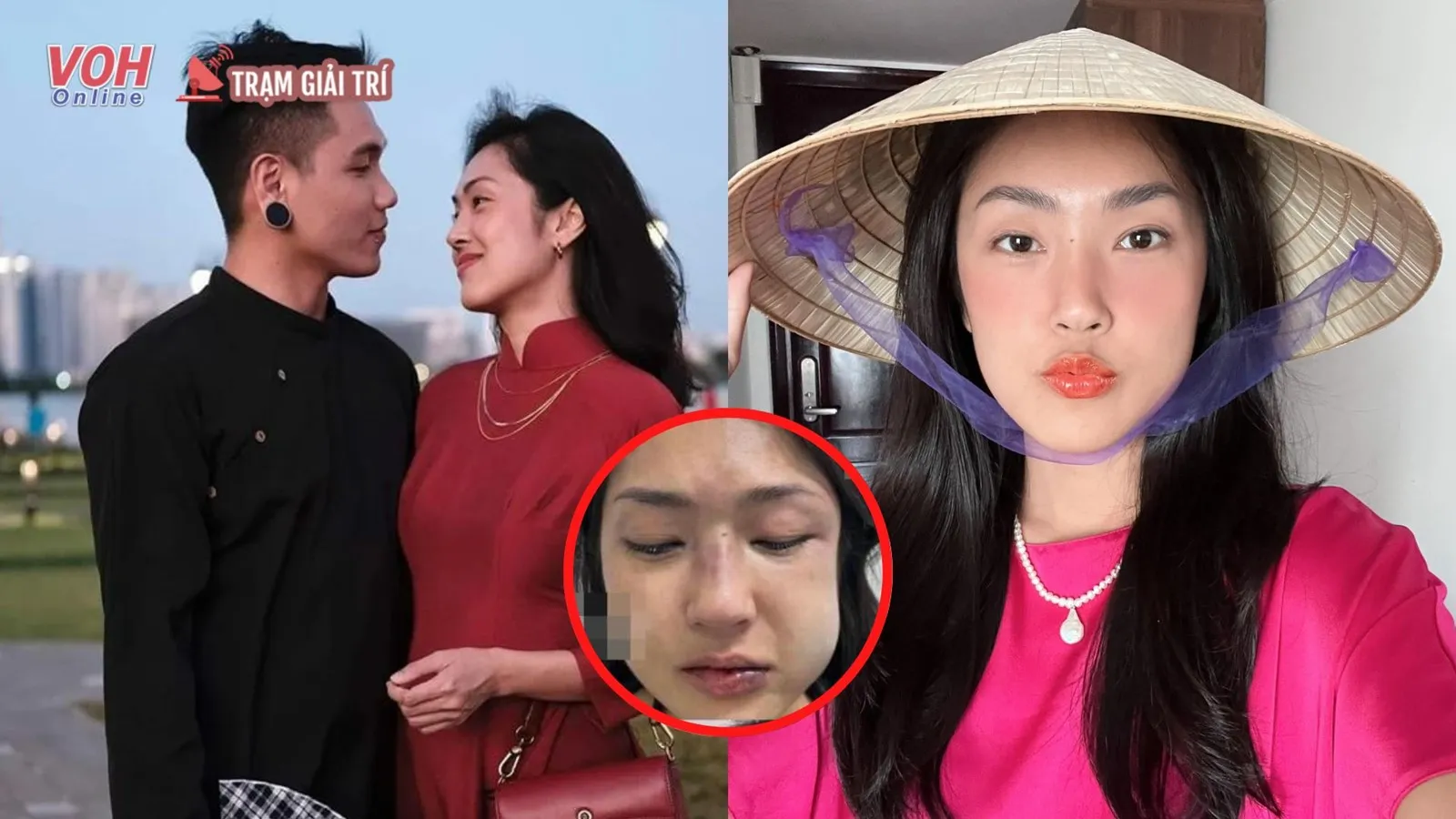 MC Misoa Kim Anh bị bạn trai tác động vật lý trong ngày sinh nhật