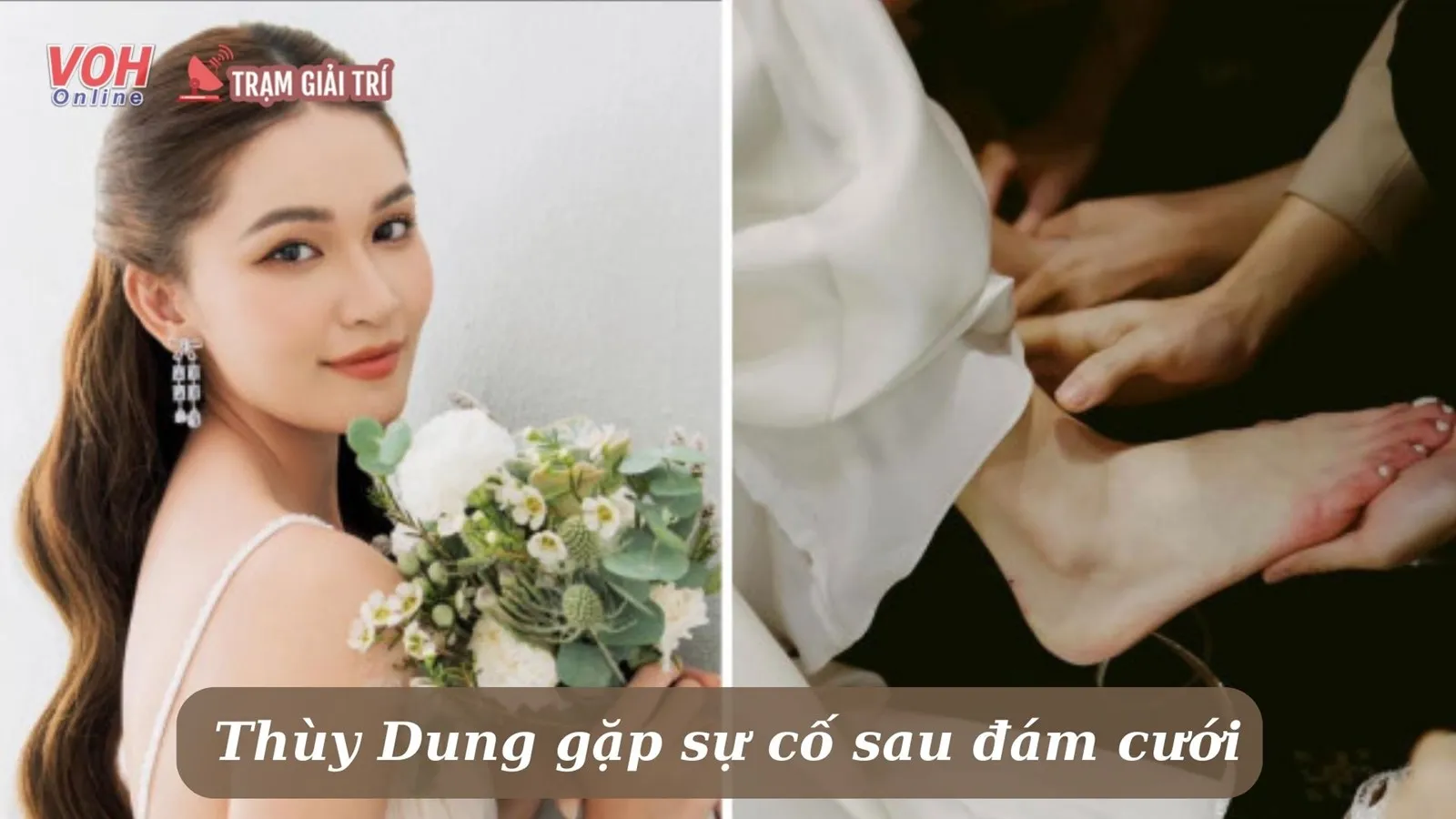 Á hậu Thùy Dung bị bỏng nặng sau đám cưới