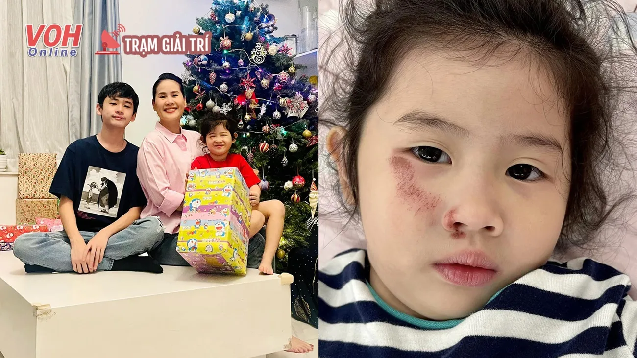 Con gái Thân Thúy Hà bị ngã xe trầy hết mặt, Tăng Thanh Hà xót xa