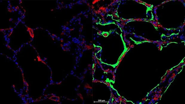 Các nhà khoa học Australia tìm ra protein ngăn SARS-CoV-2 lây lan